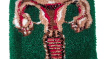 Création La Carpette - Hystérie Collective